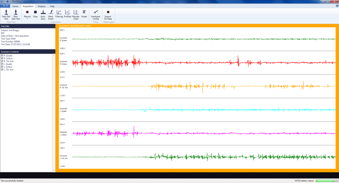 MyoDat live preview of sEMG signal from telemetry or data logger