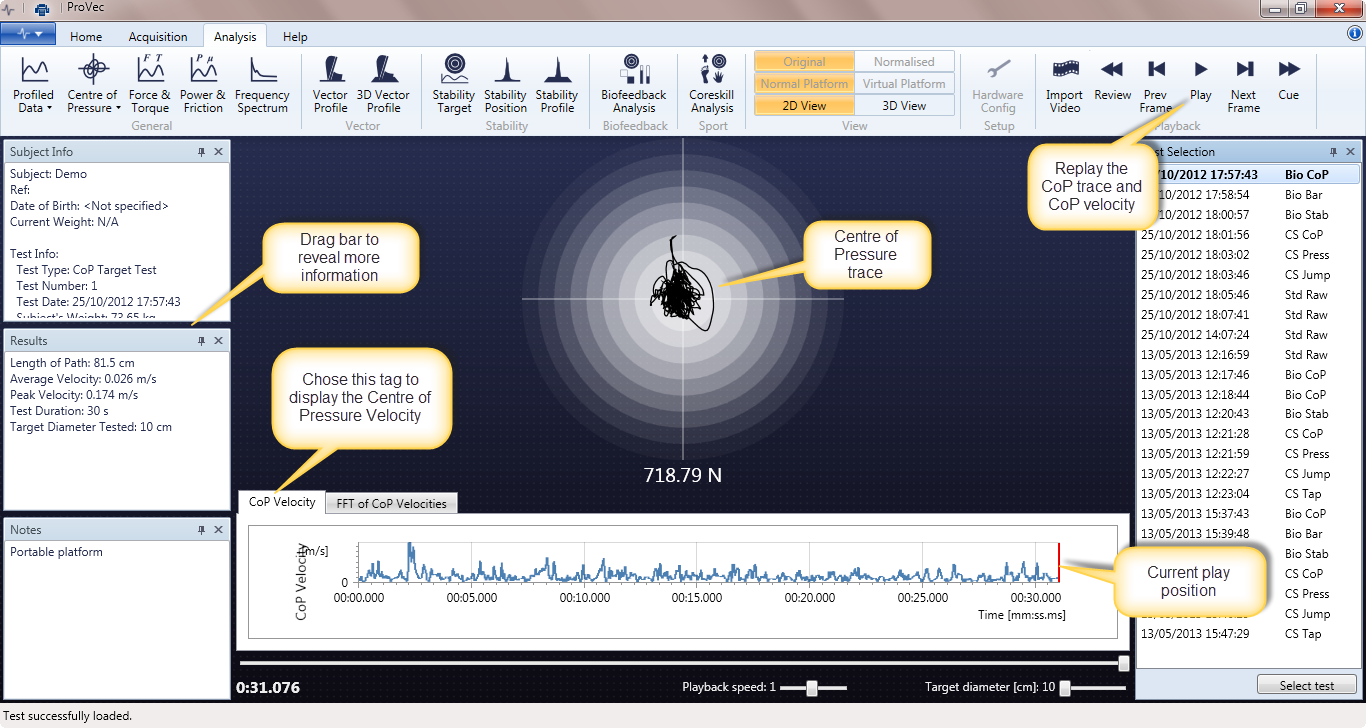 Bio-feedback balance test - live CoP, velocity and Length of Path