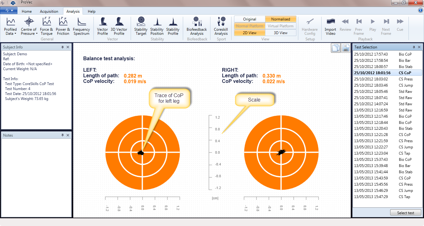 Core Skills balance test - left and right side measured separately
