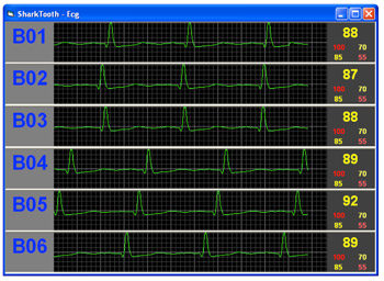 Sharktooth software - ECG waveform view