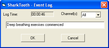 Sharktooth log event view